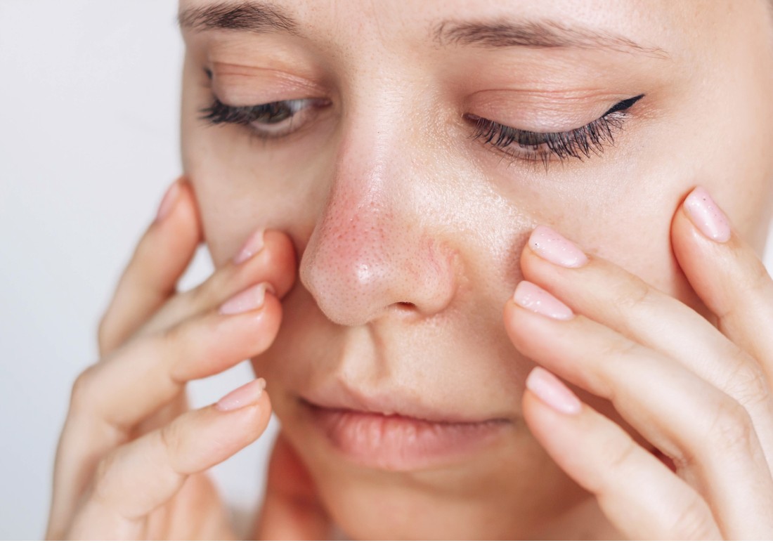3 Remedies for Dry Skin Under the Eyes Buyers Report