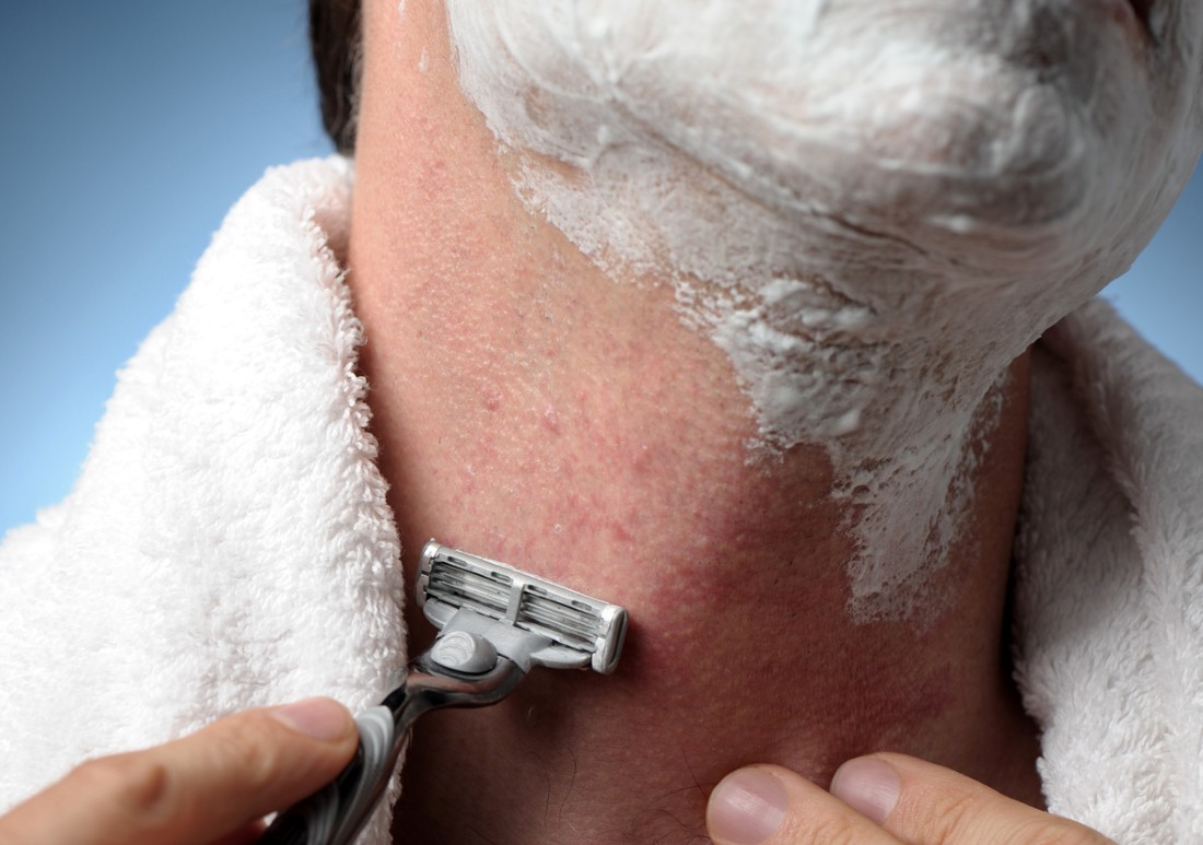 How Long Does Razor Burn Last? Buyers Report