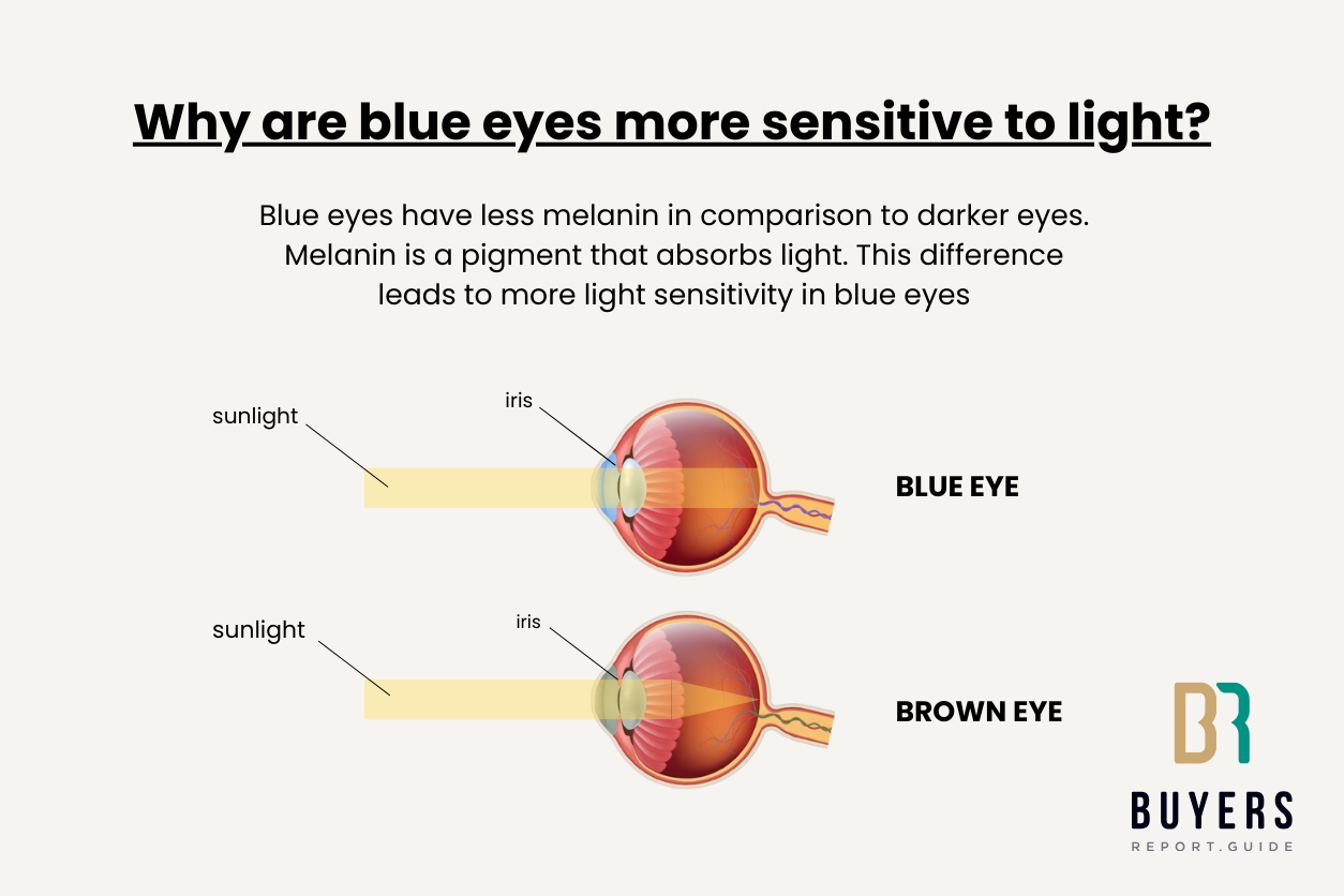 Are blue eyes more sensitive to light?