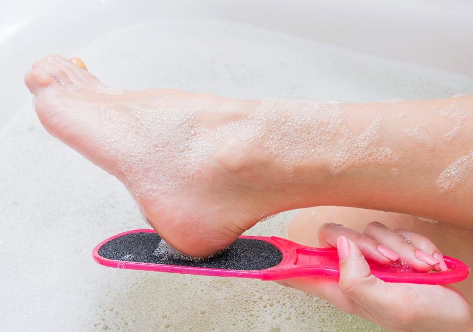 best callus remover