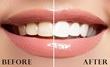 Before and after photo showing the effectiveness of the Venus Visage Stain Remover for Teeth: on the left, teeth appear stained and dull, while on the right, teeth are noticeably whiter and brighter.