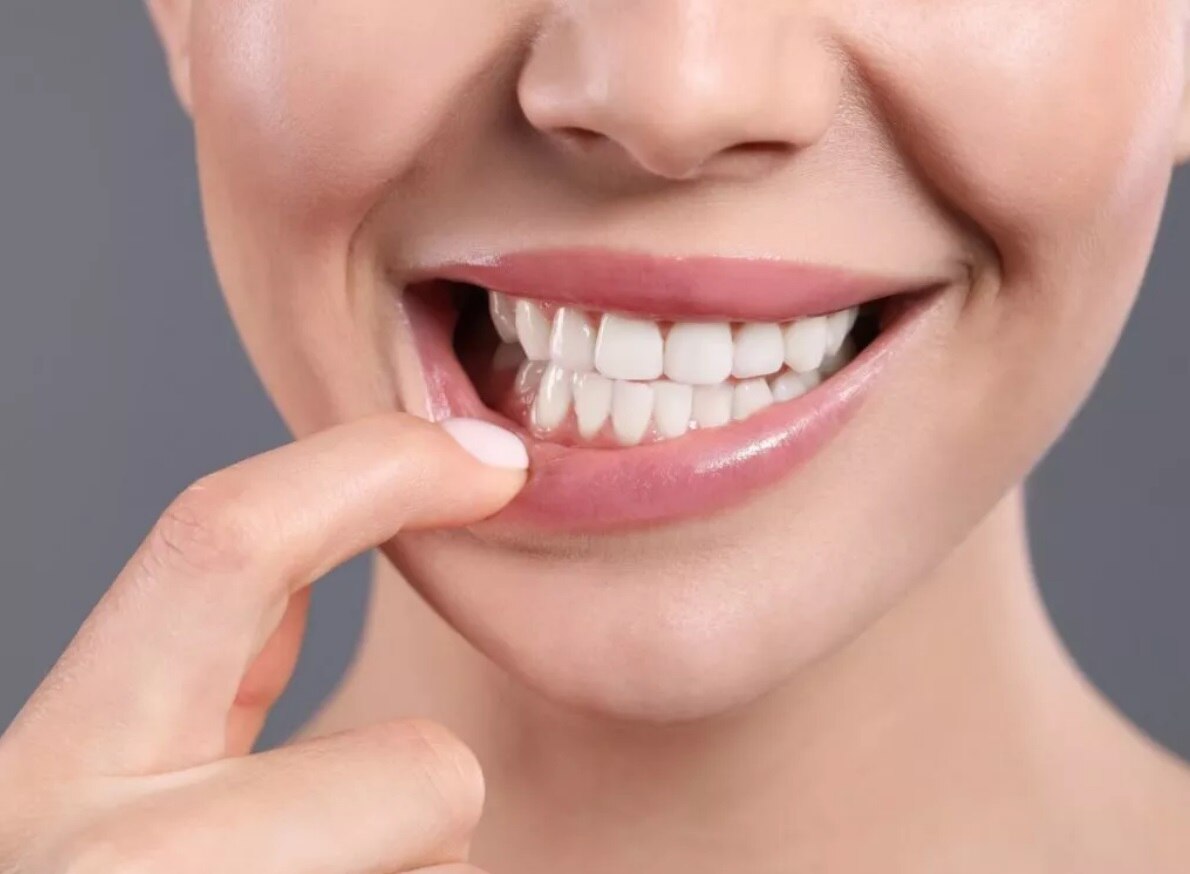 A woman smiling while gently pulling down her lower lip, revealing bright, clean teeth, demonstrating the effectiveness of a stain remover for teeth.