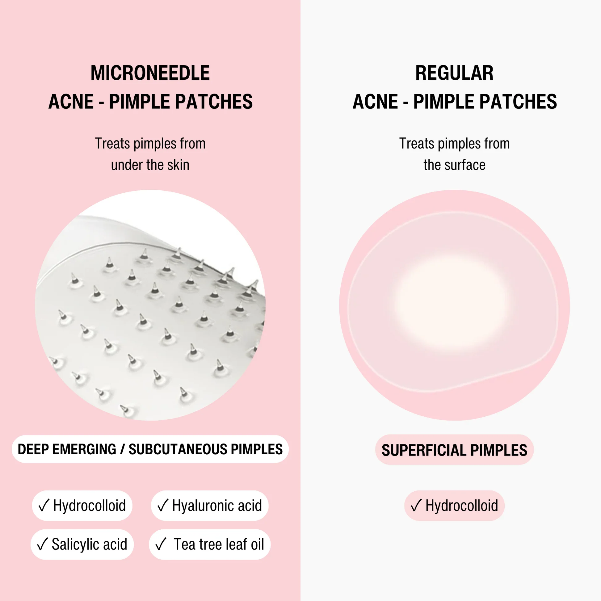 Microneedle Pimple Patches